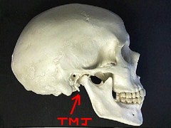 TMJ and Jaw Pain, Beverly Hills Chiropractor